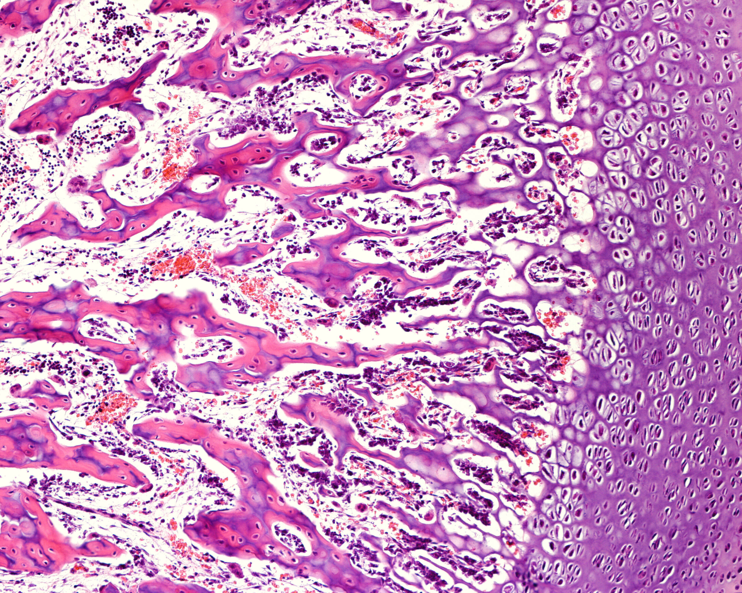Osseointegration